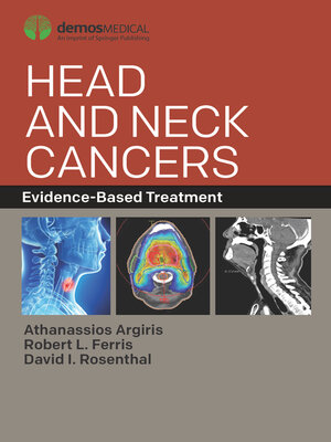 cover image of Head and Neck Cancers